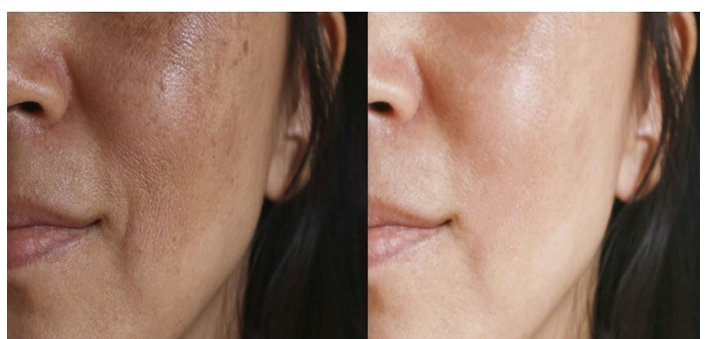 korean glass facial 